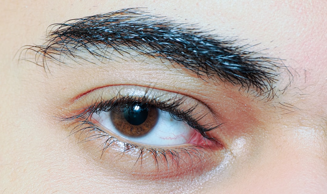 Eyelid