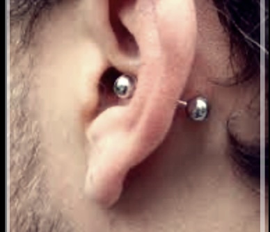 귀고름 방치하면 귀머거리 된는 이유?