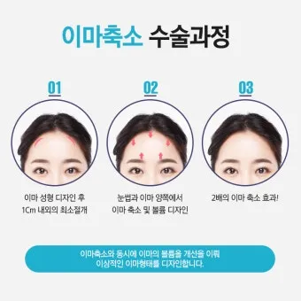 이마가 넓은 여자 관상 특징과 해석_8