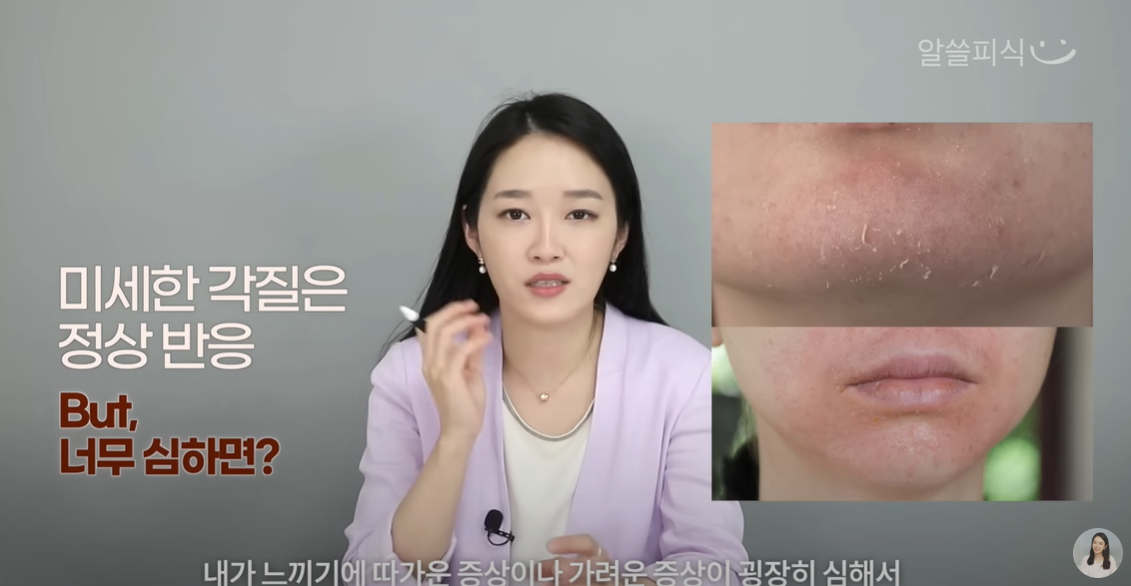 스티바a연고 혹은 스티바a크림