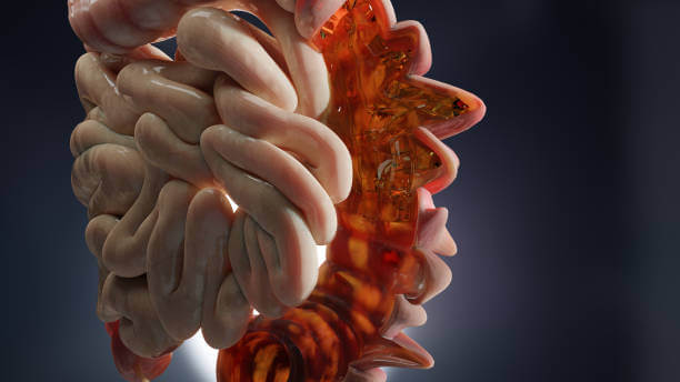 장음항진증, 배에서 꾸르륵 소리라고 하는 장음항진증은 정확히 말하면 질병이 아니라 증상입니다. 하지만 위장병의 신호일 수 있으니 가볍게 넘기기보다는 원인과 치료법을 잘 알고 증상 완화에 노력해야 합니다. 참고하시기 바랍니다.