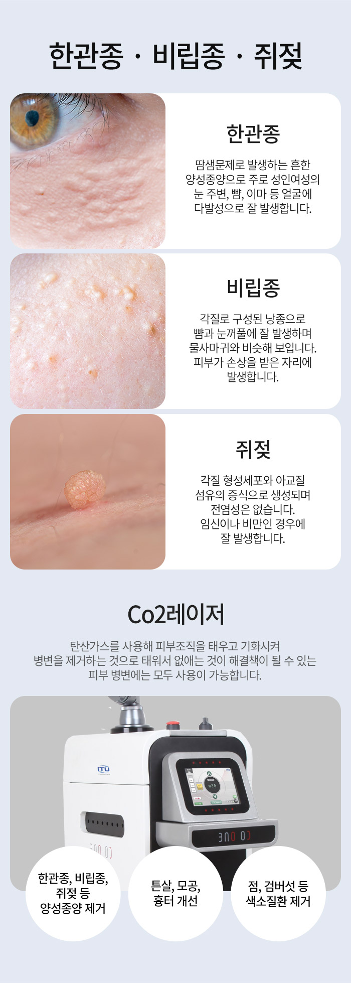 한관종 제거