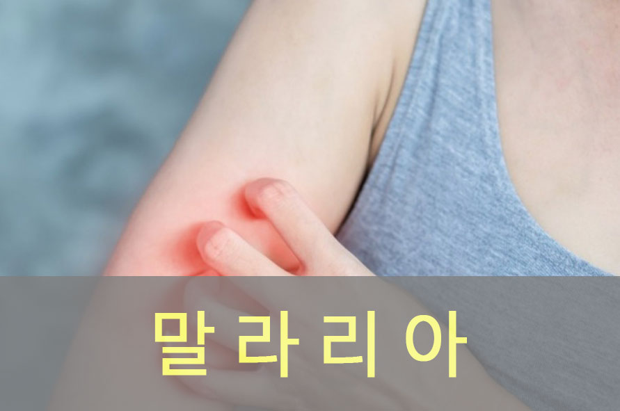 모기에게 물린 가려움증