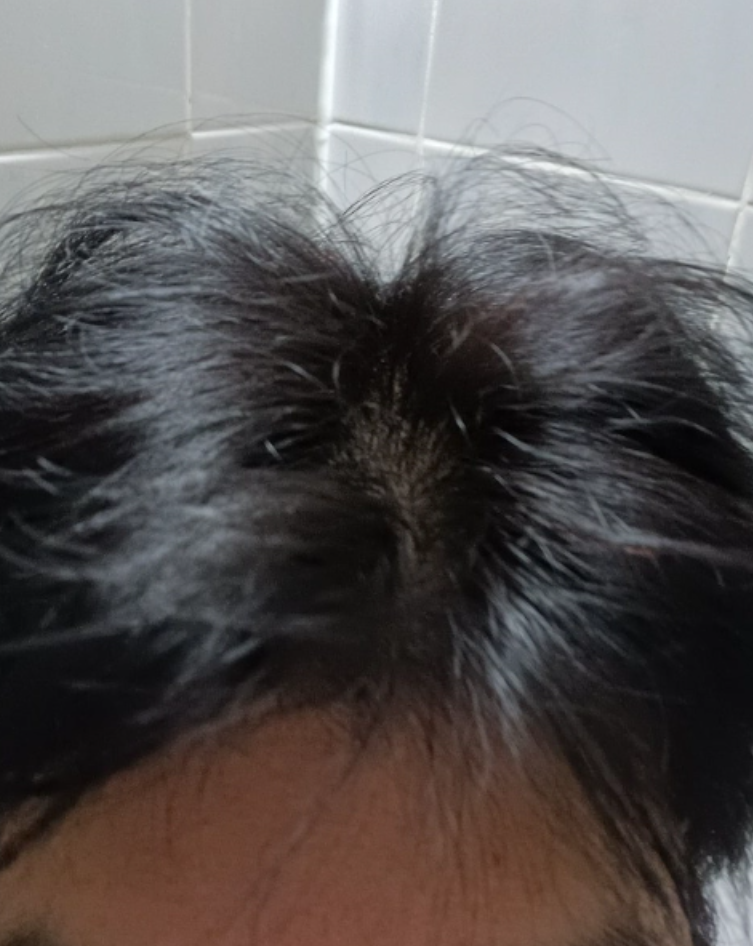 인포벨 장미화 동안 렛미모 지속성