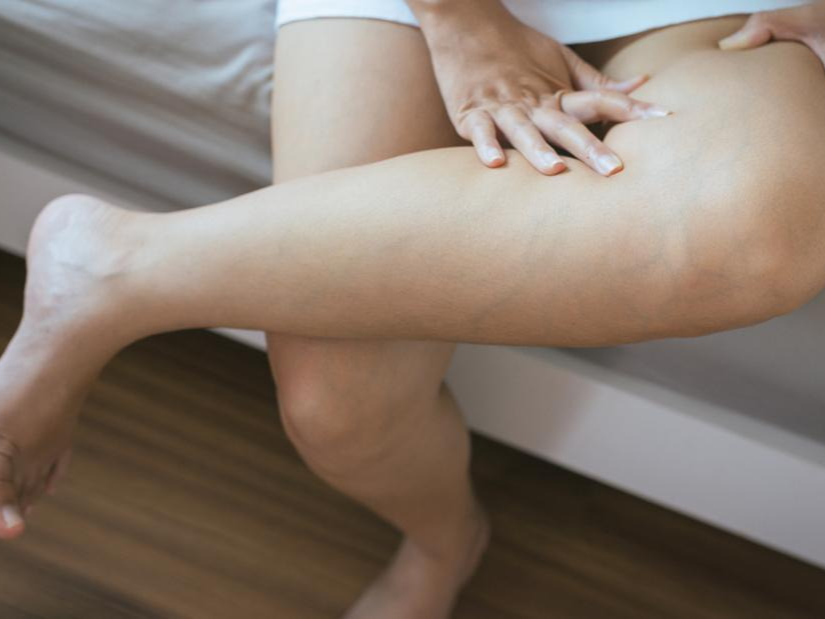 몸이 붓는 원인