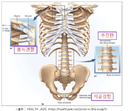 가동관절