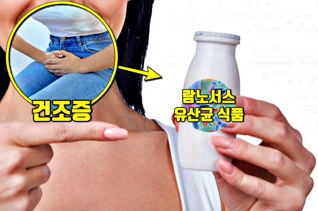 유산균 효능 여성 주부 갱년기 증상 좋은 식품 음식, 건강 팁줌