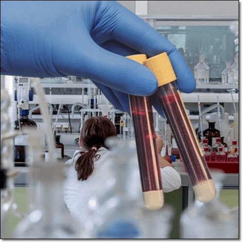 호모시스테인 수치에 따른 분류