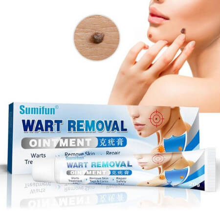 쥐젓 제거 크림의 효과와 사용법