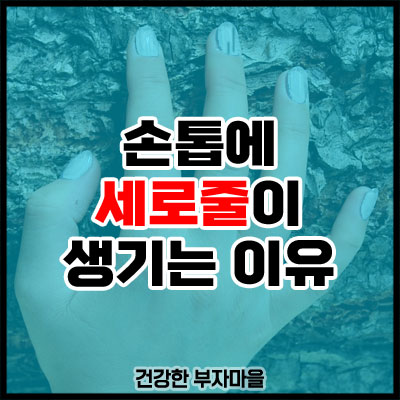 손톱에 세로줄이 생기는 이유