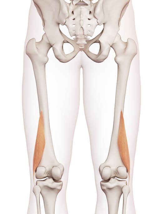대퇴이두근 단두