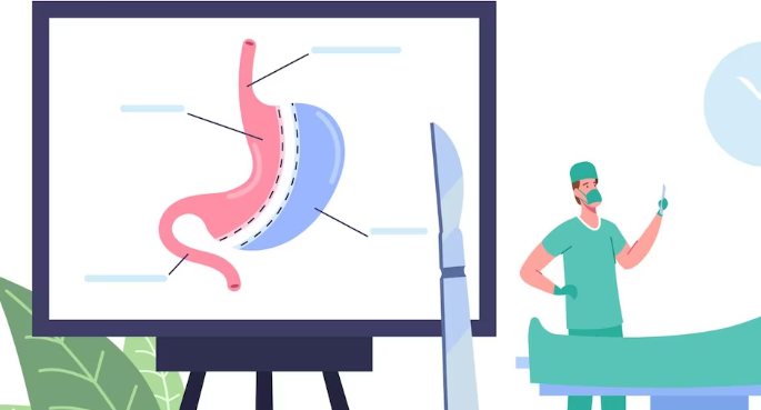 고도비만 치료법 _ 비만대사 수술 알아보아요