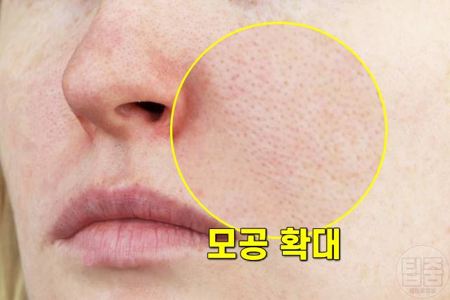 얼굴 노화 증상,피부노화 증상,모공