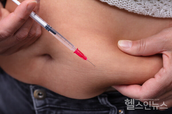 지방분해주사 지방흡입주사 효과 장점 부작용