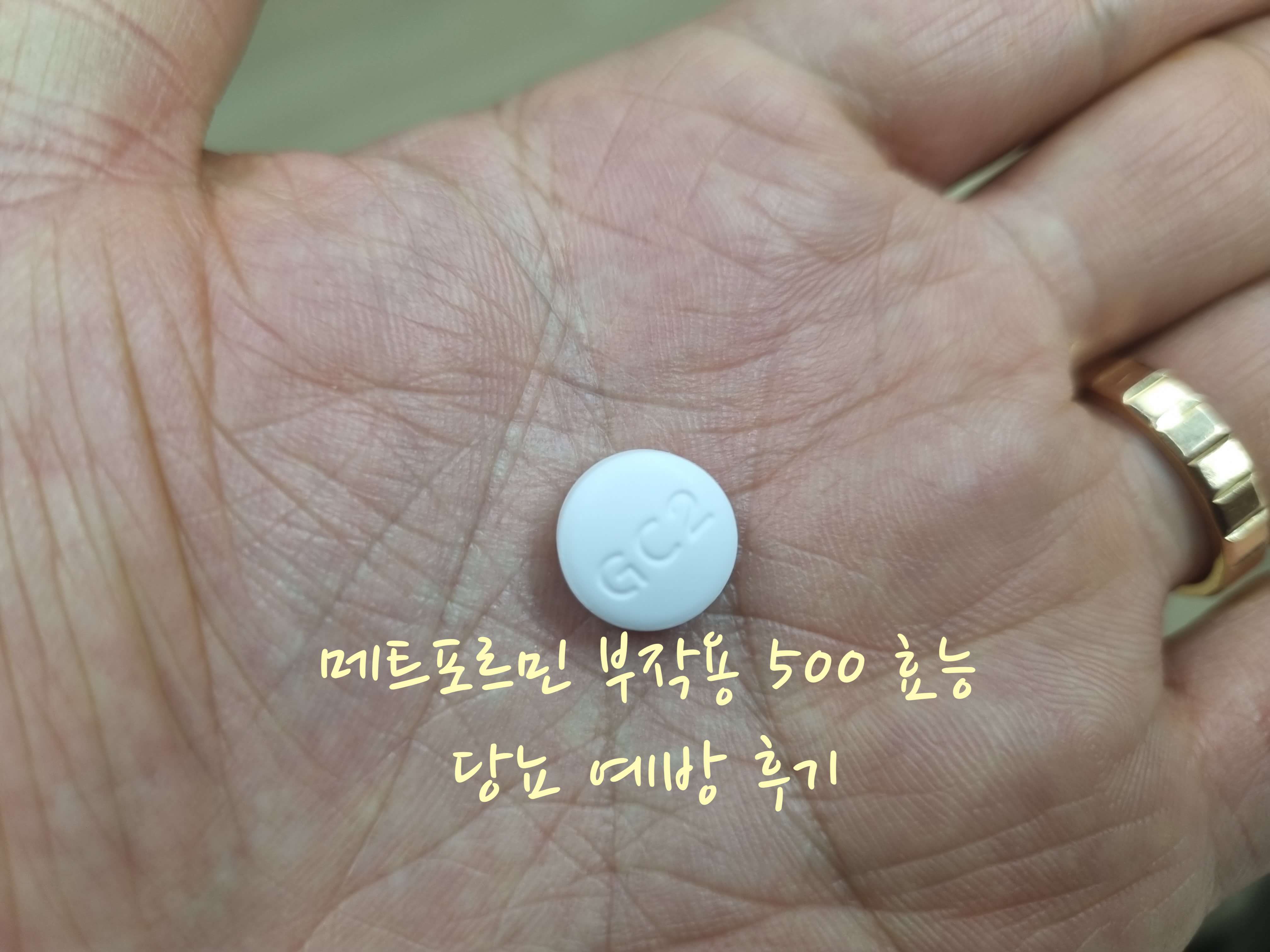 메트포르민