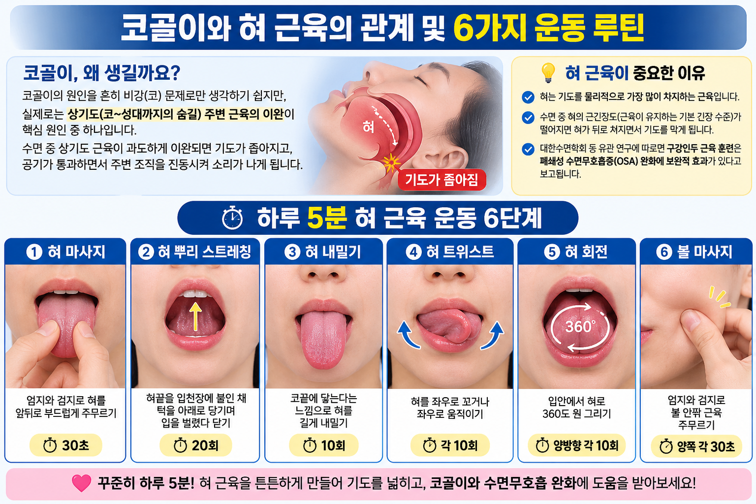 코골이와 혀 근육의 관계 및 6가지 운동 루틴