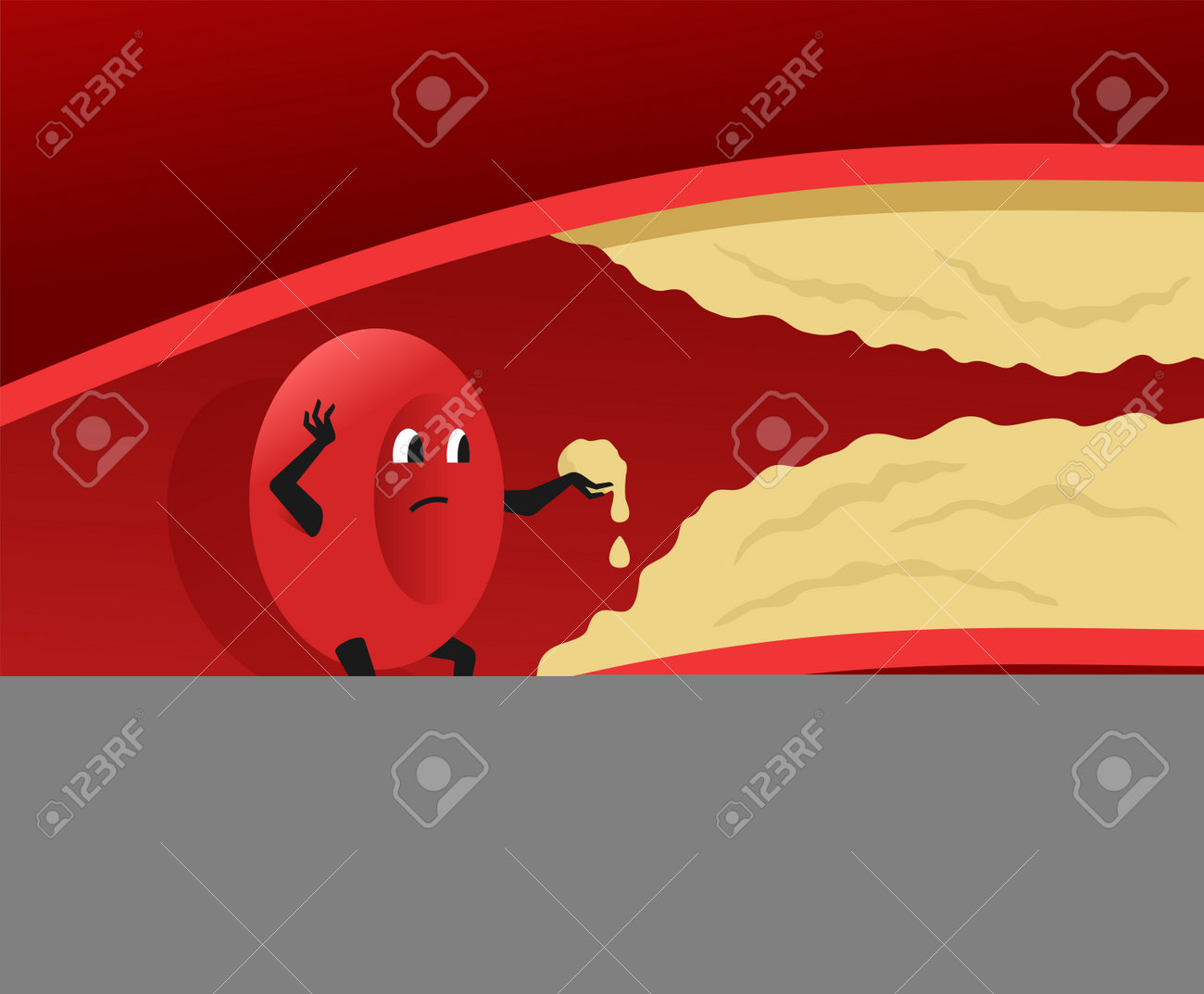 고지혈증 관리&amp;#44; 식단만 바꾸면 안 되는 이유