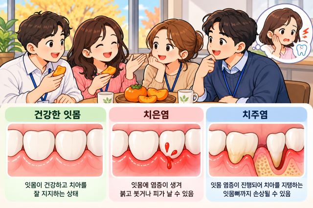 직장 동료들이 단감을 나누어 먹는 모습과 건강한 잇몸, 치은염, 치주염을 비교한 만화 일러스트