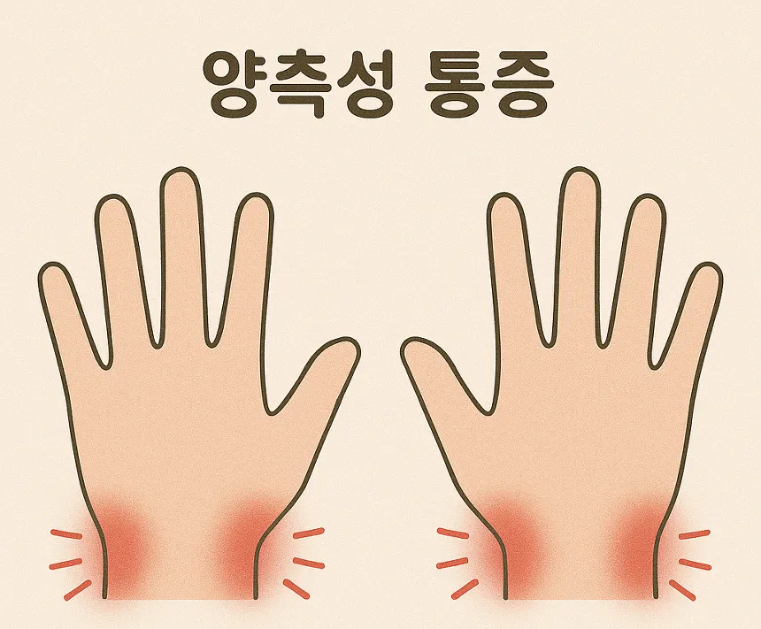 류마티스 관절염 초기증상