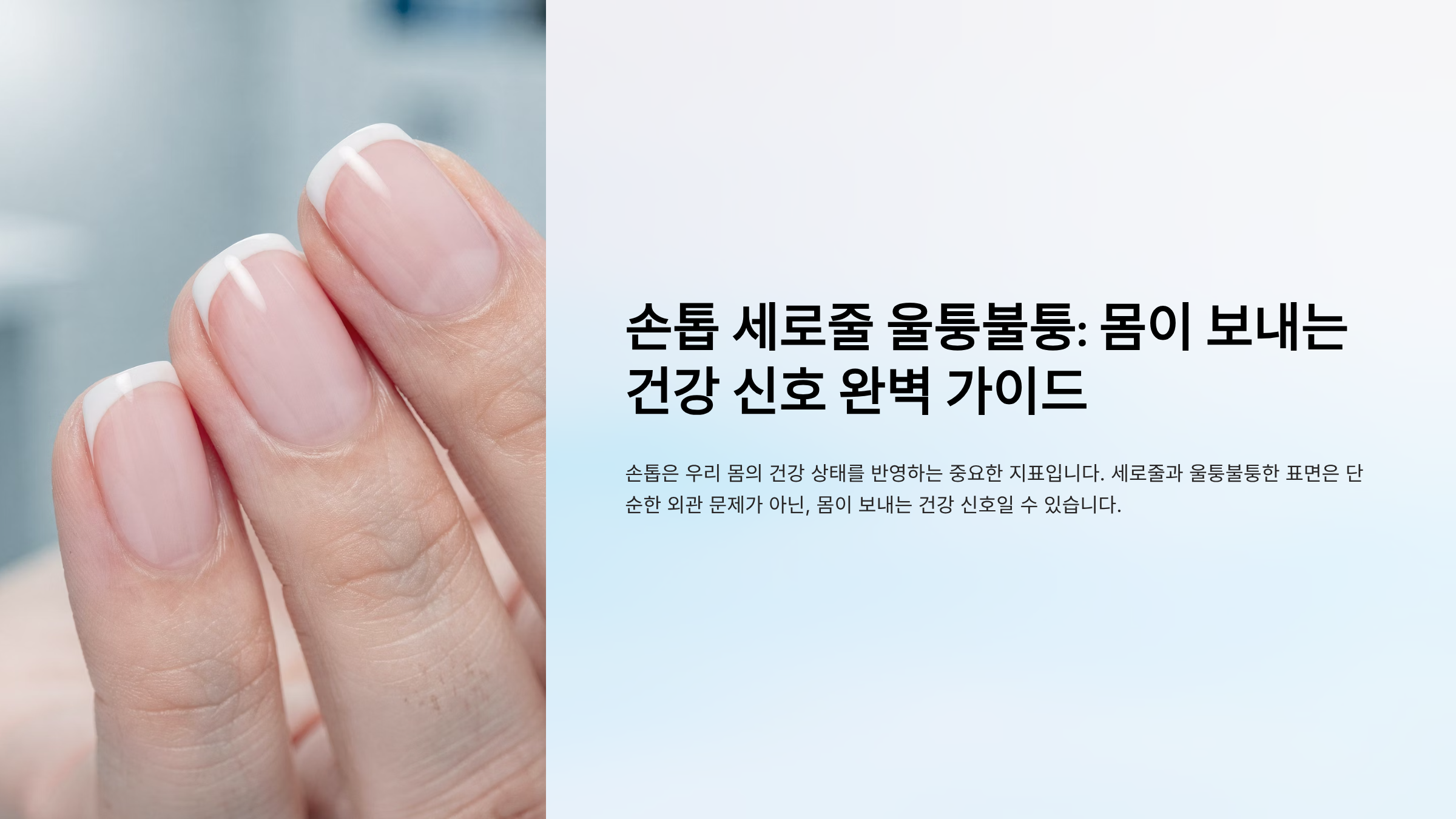 손톱 세로줄 울퉁불퉁 원인 알아보기