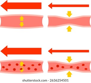 겨울철 피부 혈관 수축이 스마트워치 PPG 심박 정확도에 미치는 영향