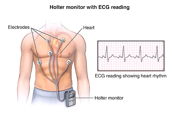 홀터-검사-holter-monitor-사진