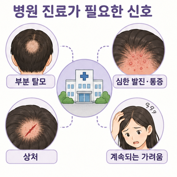 부분 탈모와 심한 발진, 두피 상처, 계속되는 가려움 등 병원 진료가 필요한 신호를 보여주는 이미지
