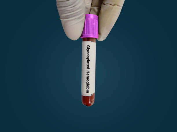 당화혈색소 정상수치 낮추는 방법