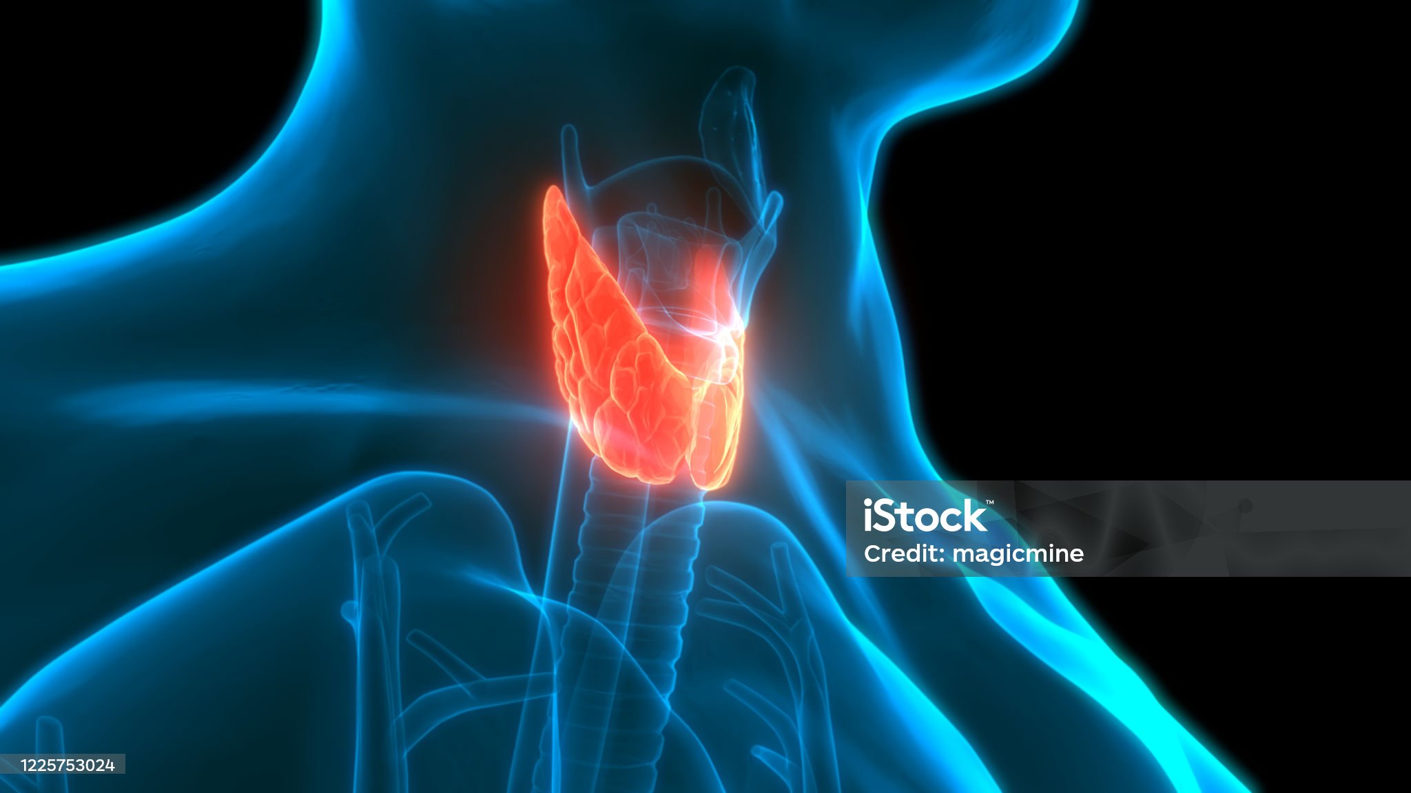 갑상선암-관련-사진