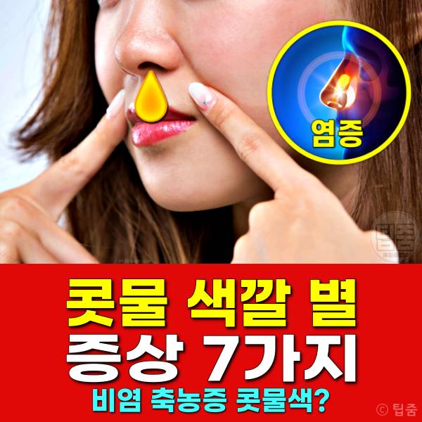 콧물 색깔별 증상,콧물 색깔로 보는 건강,비염 축농증