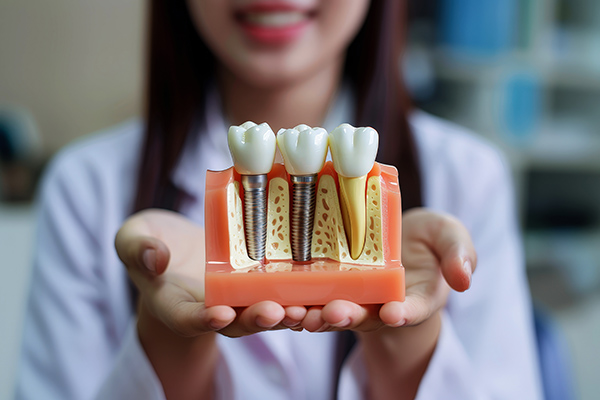 임플란트 시술과정