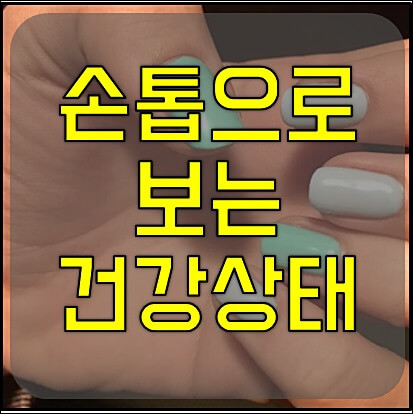 손톱으로 보는 질병 1