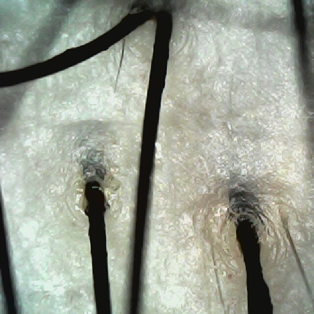 탈모 극복 프로젝트 - 뒷머리 두피 모습이다.