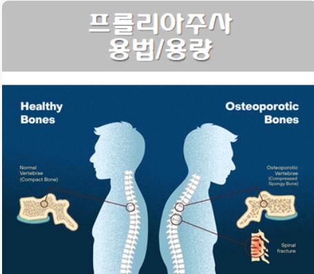 골다공증 주사 치료