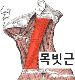 목빗근(흉쇄유돌근)