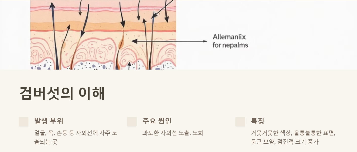 검버섯 없애는 방법