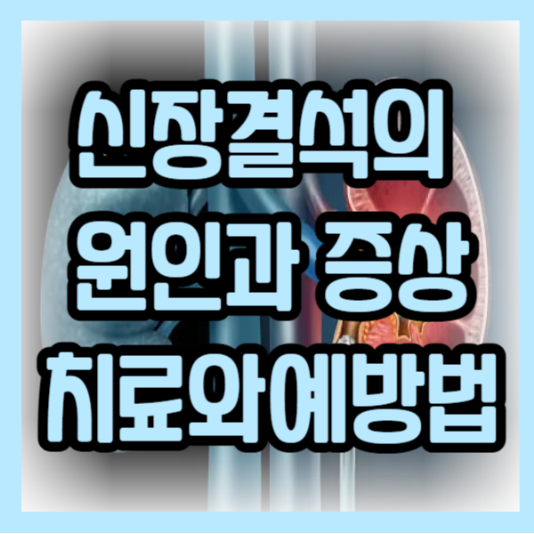 신장결석의 원인과 증상,치료와예방법