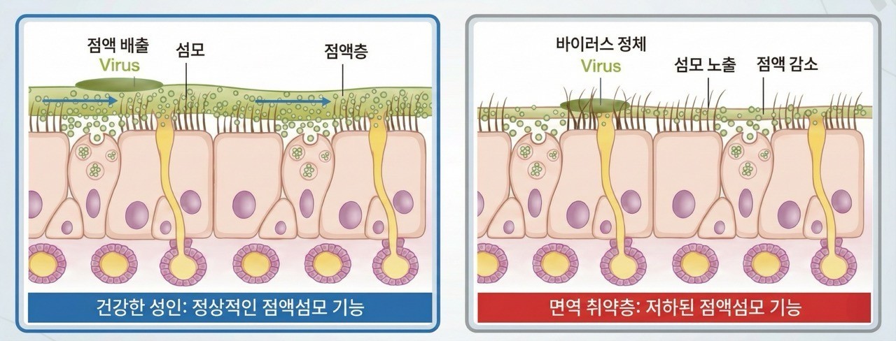 우리의 코 속에 바이러스를 제거하는 점액과 섬모