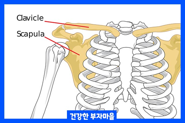 오십견 치료방법