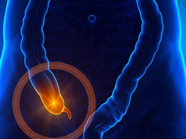 충수염의 합병증