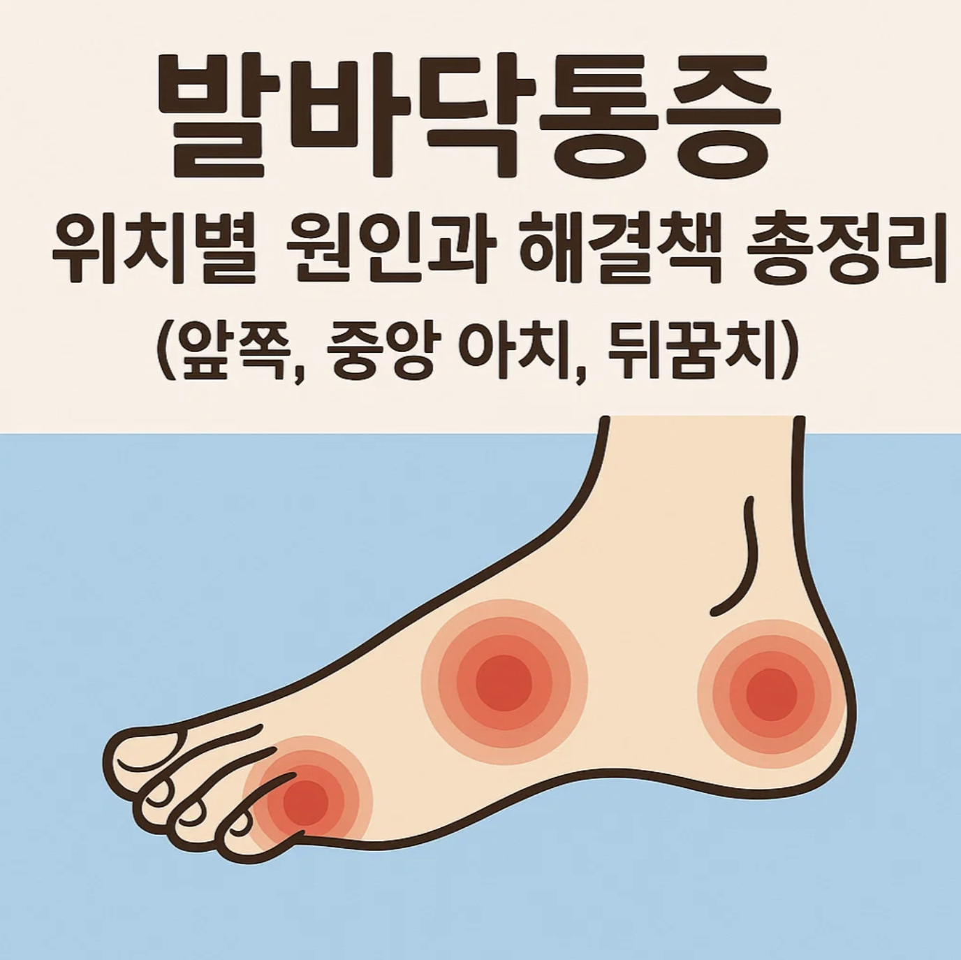 발바닥통증 위치별 원인과 해결책 총정리 (앞쪽, 중앙 아치, 뒤꿈치)