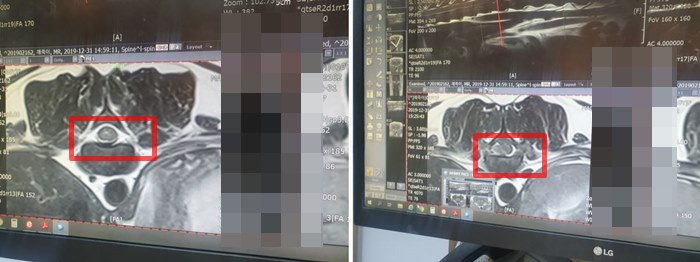 강아지-허리디스크-MRI-사진