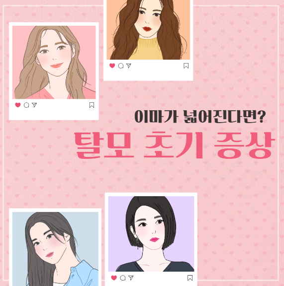 이마가 넓어졌다면? 탈모 초기 증상 바로 알기