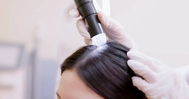 탈모 예방 방법