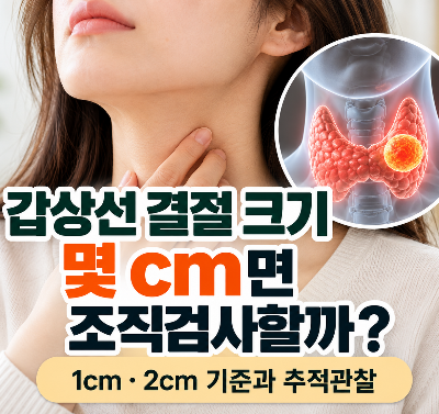 갑상선 결절 크기와 조직검사 기준을 설명하는 건강정보 썸네일