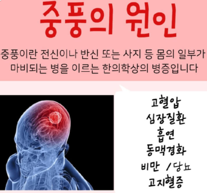 중풍의 원인