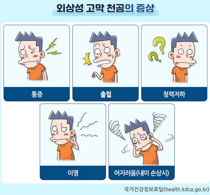 귀 건강 신경써야 할 계절, 여름