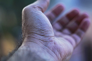 손목터널증후군-이미지