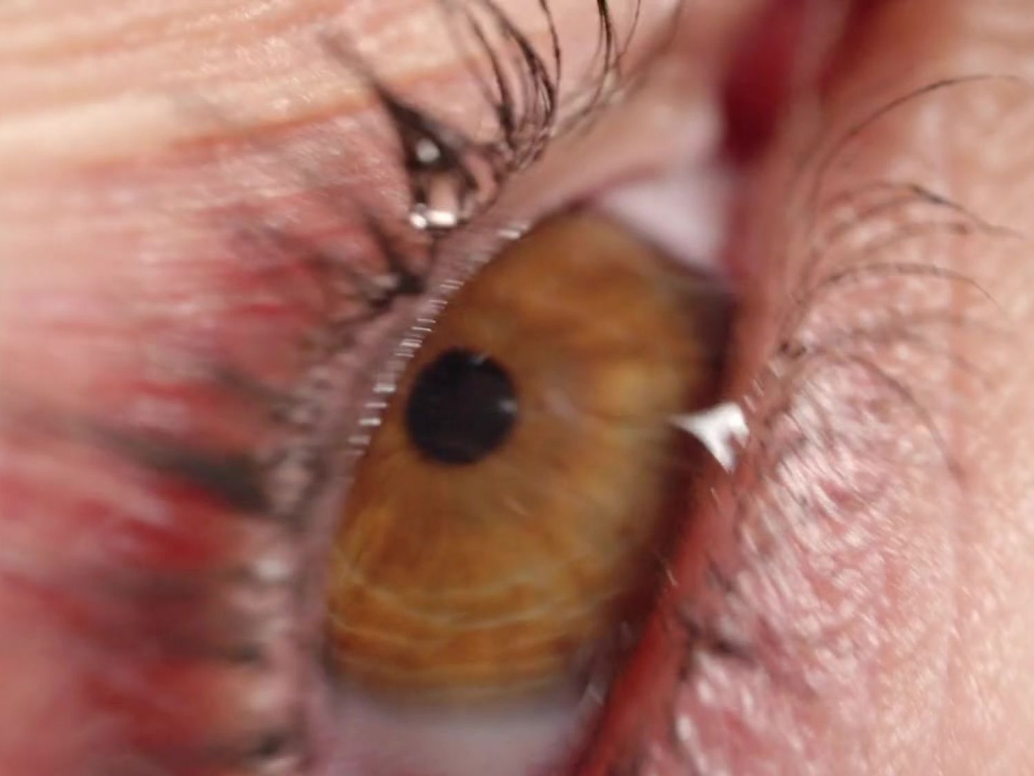 안구건조증 증상