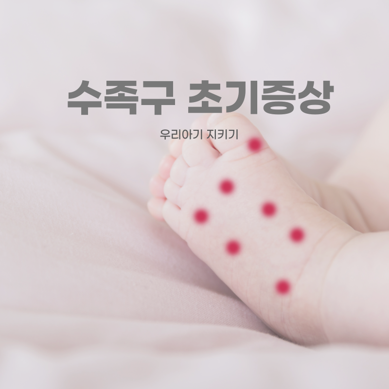 수족구초기증상